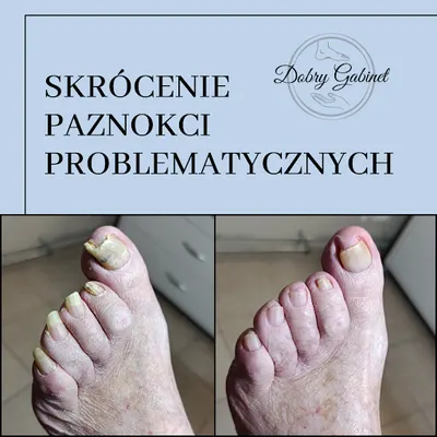 Dobry Gabinet - Podologia